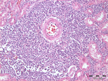 Histopath MCF